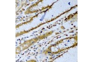 anti-beta-TrCP antibody
