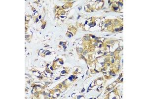 Immunohistochemistry (IHC) image for anti-Coiled-Coil Domain Containing 124 (CCDC124) (AA 1-223) antibody (ABIN7266433)
