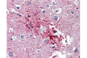 Anti-HMGN1 antibody IHC of human brain, cortex, senile plaque. (HMGN1 抗体  (AA 36-85))