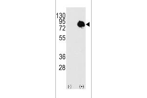 Western blot analysis of TGM2 using rabbit polyclonal using 293 cell lysates (2 ug/lane) either nontransfected (c) or transiently transfected with the TGM2 gene (Lane 2). (Transglutaminase 抗体  (AA 413-442))