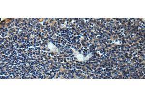 Immunohistochemistry of paraffin-embedded Human tonsil tissue using ERLIN1 Polyclonal Antibody at dilution of 1:50(x200) (ERLIN1 抗体)