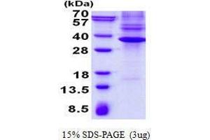 Figure annotation denotes ug of protein loaded and % gel used. (NKX3-1 蛋白)