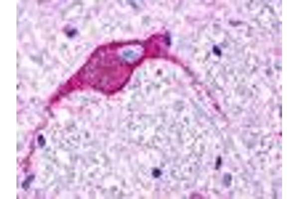 GPR174 抗体  (Extracellular Domain)