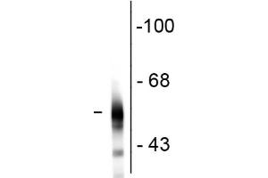 Western Blot - Mouse Anti-Tubulin B III antibody Western Blot of Mouse Anti-Tubulin ß III antibody. (TUBB3 抗体)