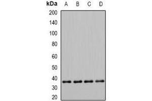 Western blot analysis of PDHB expression in Hela (A), Jurkat (B), mouse skeletal muscle (C), rat heart (D) whole cell lysates. (PDHB 抗体)