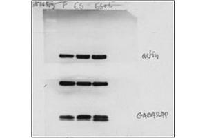 Western blot done using standard conditions on WT MEFs, starved with EBSS for 2 hours with and without leupeptin before lysing.