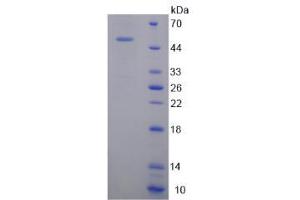 SDS-PAGE analysis of Tenascin C Protein. (TNC 蛋白)