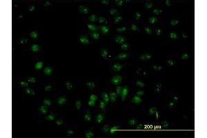 Immunofluorescence of purified MaxPab antibody to NOP56 on HeLa cell. (NOP56 抗体  (AA 49-174))