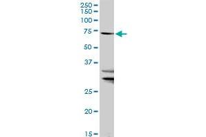 SLC27A1 MaxPab rabbit polyclonal antibody. (SLC27A1 抗体  (AA 1-646))