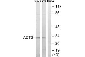 Western blot analysis of extracts from HepG2 cells and 293 cells, using SLC25A6 antibody. (SLC25A6 抗体  (Internal Region))