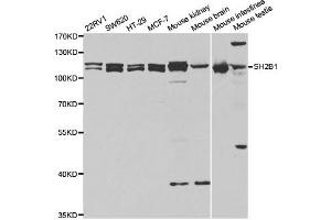 Western Blotting (WB) image for anti-SH2B Adaptor Protein 1 (SH2B1) antibody (ABIN1876744) (SH2B1 抗体)