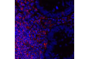 Immunofluorescence (IF) image for anti-Protein tyrosine Phosphatase, Receptor Type, C (PTPRC) (C-Term) antibody (ABIN7454030)