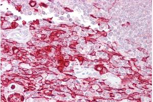 Immunohistochemistry with Thymus tissue at an antibody concentration of 5µg/ml using anti-ATF1 antibody (ARP31366_P050) (AFT1 抗体  (Middle Region))