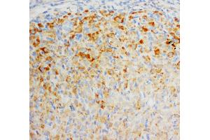 Anti-FGF8 antibody, IHC(P) IHC(P): Rat Ovary Tissue (FGF8 抗体  (C-Term))
