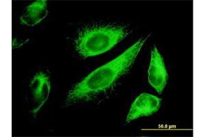 Immunofluorescence of monoclonal antibody to KRT18 on HeLa cell. (Cytokeratin 18 抗体  (AA 1-430))