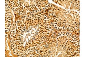 ABIN7094313 and ABIN7098360 at 1/100 staining Mouse testis tissue by IHC-P. (IWS1 抗体  (N-Term))