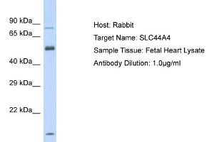 Host: Rabbit Target Name: SLC44A4 Sample Tissue: Human Fetal Heart Antibody Dilution: 1ug/ml (SLC44A4 抗体  (Middle Region))