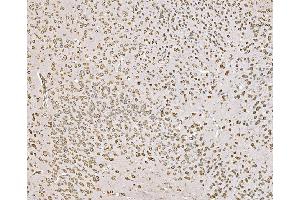 IHC analysis of SND1 using anti-SND1 antibody (ABIN7600525). (SND1 抗体  (AA 20-204))