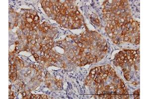 Image no. 2 for anti-Eukaryotic Translation Initiation Factor 4 gamma 3 (EIF4G3) (AA 1-516) antibody (ABIN599055) (EIF4G3 抗体  (AA 1-516))