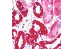 Immunohistochemical analysis of Aquaporin 2 staining in human kidney formalin fixed paraffin embedded tissue section. (AQP2 抗体  (C-Term))