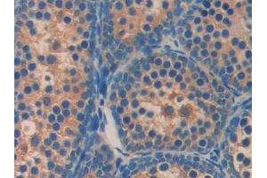 Detection of AGRP in Mouse Testis Tissue using Polyclonal Antibody to Agouti Related Protein (AGRP) (AGRP 抗体  (AA 21-131))