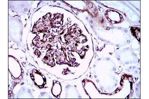Immunohistochemical analysis of paraffin-embedded kidney tissues using SYCP3 mouse mAb with DAB staining. (SYCP3 抗体  (AA 27-128))