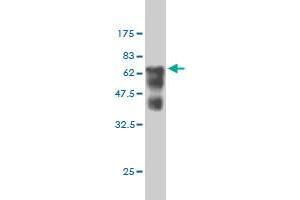 Western Blot detection against Immunogen (66 KDa) . (SMS 抗体  (AA 1-366))
