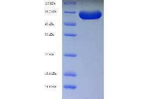 SDS-PAGE (SDS) image for Receptor-Interacting Serine-threonine Kinase 2 (RIPK2) (AA 1-540), (full length) protein (His tag) (ABIN5710260)