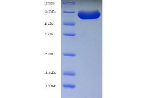 SDS-PAGE (SDS) image for Receptor-Interacting Serine-threonine Kinase 2 (RIPK2) (AA 1-540), (full length) protein (His tag) (ABIN5710260) (RIPK2 Protein (AA 1-540, full length) (His tag))