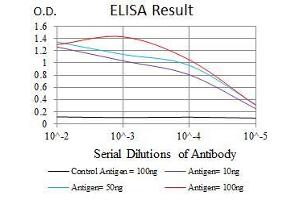 Black line: Control Antigen (100 ng), Purple line: Antigen(10 ng), Blue line: Antigen (50 ng), Red line: Antigen (100 ng), (SQSTM1 抗体  (AA 232-356))