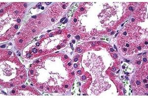 Immunohistochemistry (Formalin-fixed Paraffin-embedded Sections) (IHC (fp)) image for anti-Solute Carrier Family 11 (Proton-Coupled Divalent Metal Ion Transporters), Member 2 (SLC11A2) (AA 1-66) antibody (ABIN626125)