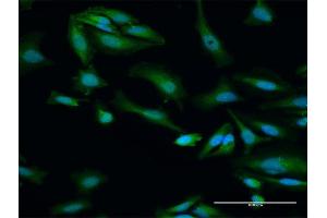 Immunofluorescence of purified MaxPab antibody to ORC6L on HeLa cell. (ORC6 抗体  (AA 1-252))