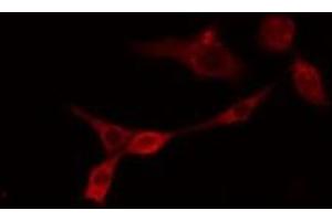 ABIN6275565 staining RAW264. (SHANK2 抗体  (Internal Region))