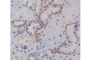 IHC-P analysis of kidney tissue, with DAB staining. (TAP1 抗体  (AA 525-808))