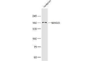 Mouse cerebrum lysates probed with MAGI3 Polyclonal Antibody, Unconjugated  at 1:300 dilution and 4˚C overnight incubation. (MAGI3 抗体  (AA 181-280))