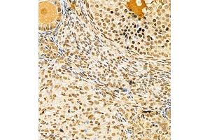 Immunohistochemistry of paraffin embedded mouse ovary using scr3 (ABIN7074886) at dilution of 1:1000 (400x lens)