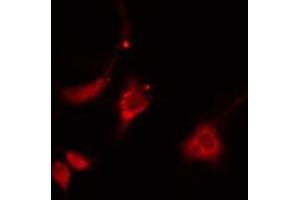 ABIN6274873 staining HepG2 cells by IF/ICC. (ATP5H 抗体  (C-Term))