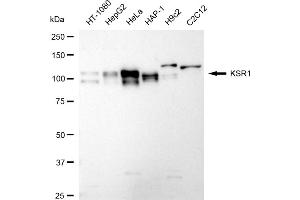 Western blotting analysis using KSR1 antibody (ABIN7799197).