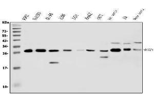 Western blot analysis of RanBP1 using anti-RanBP1 antibody (ABIN5518868). (RANBP1 抗体  (AA 2-201))