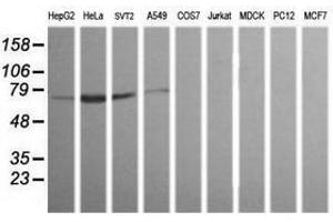 Image no. 1 for anti-ERG, ETS transcription factor (ERG) antibody (ABIN1498080) (ERG 抗体)