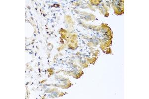 Immunohistochemistry of paraffin-embedded mouse lung using Vitronectin antibody (ABIN3022357, ABIN3022358, ABIN3022359 and ABIN6218758) at dilution of 1:100 (40x lens). (Vitronectin 抗体  (AA 364-478))