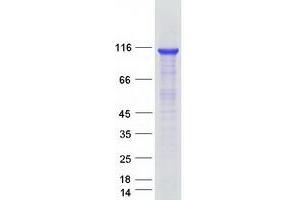 Western Blotting (WB) image for Exosome Complex Exonuclease RRP44 (DIS3) (Transcript Variant 1) protein (Myc-DYKDDDDK Tag) (ABIN2719499)