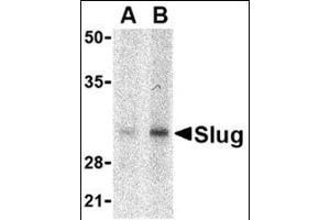Western blot analysis of Slug in human kidney cell lysate with this product at in (A) 1 and (B) 2 μg/ml. (SLUG 抗体  (Center))