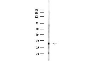 anti-Deoxyribonuclease II, Lysosomal (DNASE2) (Internal Region) antibody