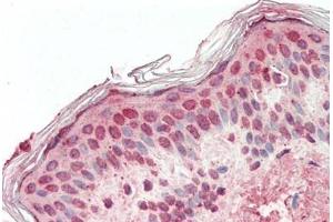 Human, Skin: Formalin-Fixed Paraffin-Embedded (FFPE) (PBX2 抗体  (N-Term))
