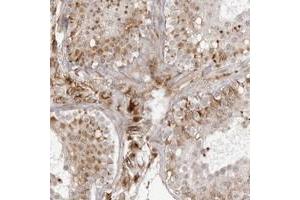 Immunohistochemical staining of human testis with TCTEX1D1 polyclonal antibody  shows cytoplasmic positivity in leydig and Sertoli cells at 1:500-1:1000 dilution. (TCTEX1D1 抗体)