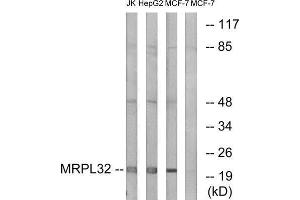 Western Blotting (WB) image for anti-Mitochondrial Ribosomal Protein L32 (MRPL32) (Internal Region) antibody (ABIN1850558) (MRPL32 抗体  (Internal Region))