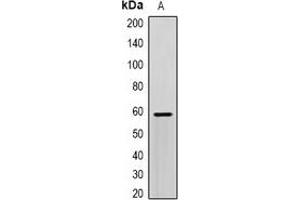 Western blot analysis of SCP2 expression in HepG2 (A) whole cell lysates. (SCP2 抗体)