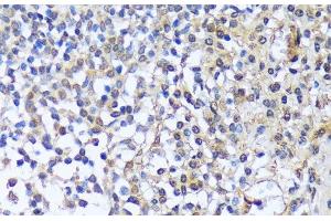 Immunohistochemistry of paraffin-embedded Human tonsil using A1CF Polyclonal Antibody at dilution of 1:100 (40x lens). (A1CF 抗体)