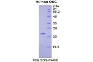 SDS-PAGE analysis of Human Oxidosqualene Cyclase Protein. (LSS 蛋白)
